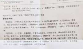 麻烦推荐上海肿瘤医院做肾脏手术的医生