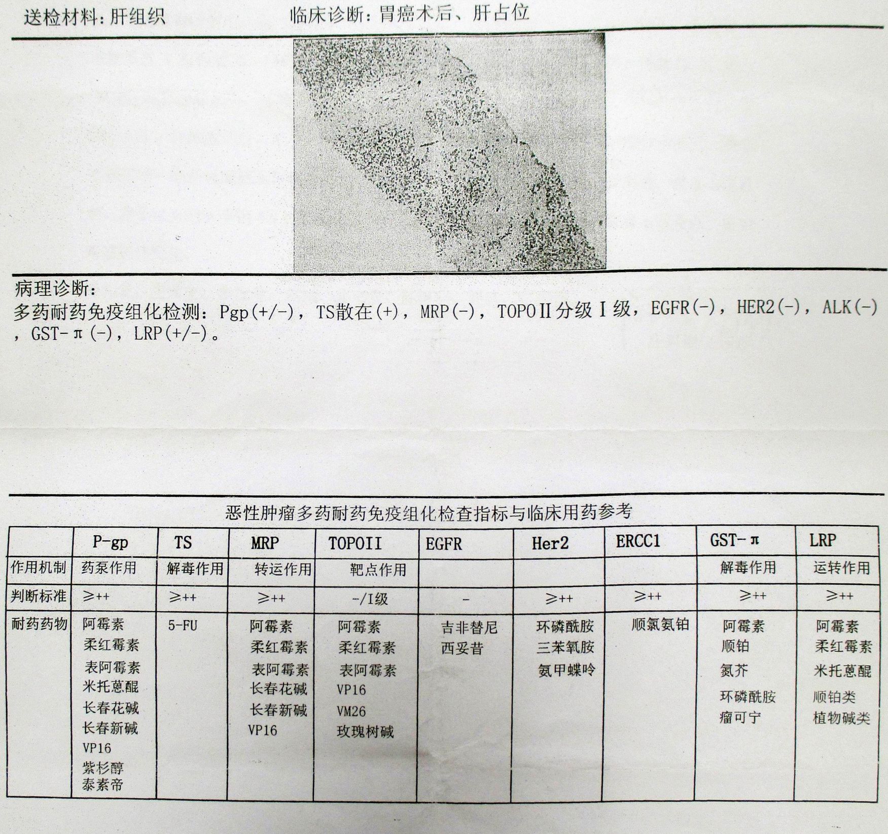 组化