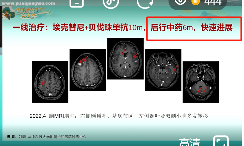 感慨！！！一个非常令人伤感的病例